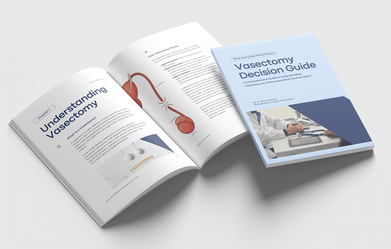 The Vasectomy Decision Guide